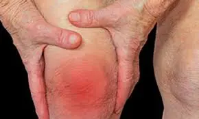 Joint Pain