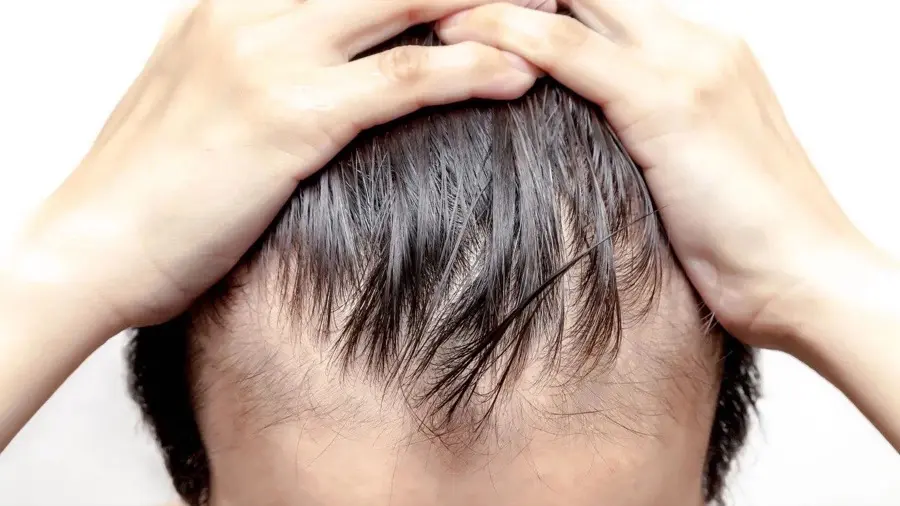 Hairfall & Skin Care