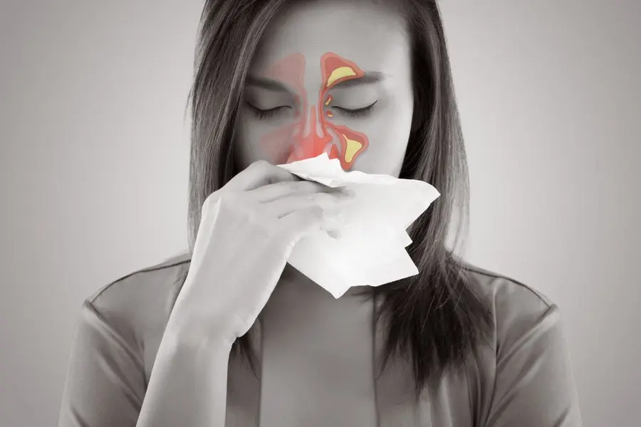 Allergic Conditions